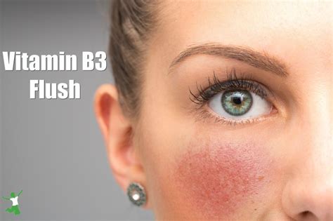 vitamins that cause rosacea flushing.